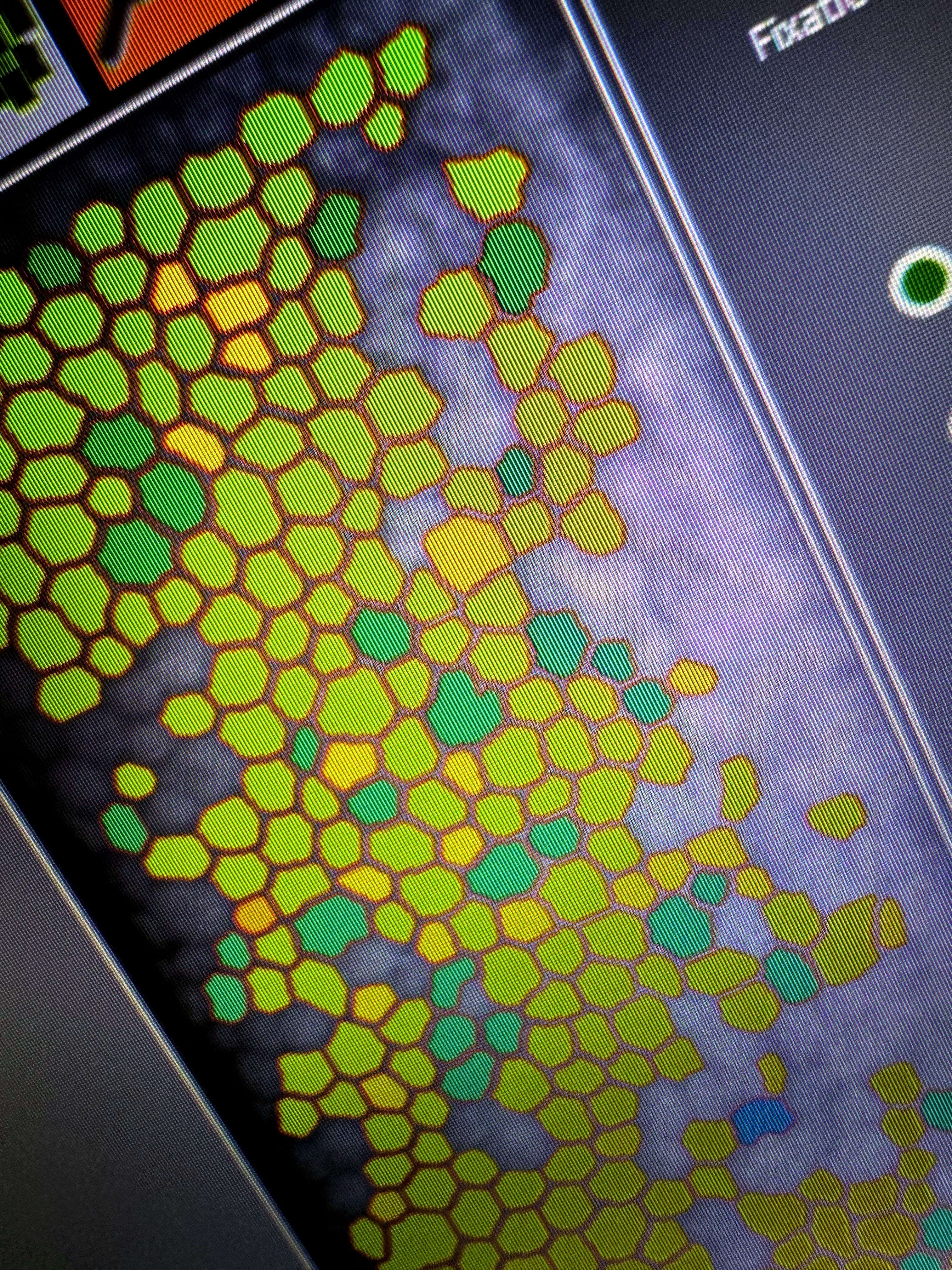 Biomicroscopia endoteliale: mosaico delle cellule endoteliali corneali analizzato dal microscopio speculare