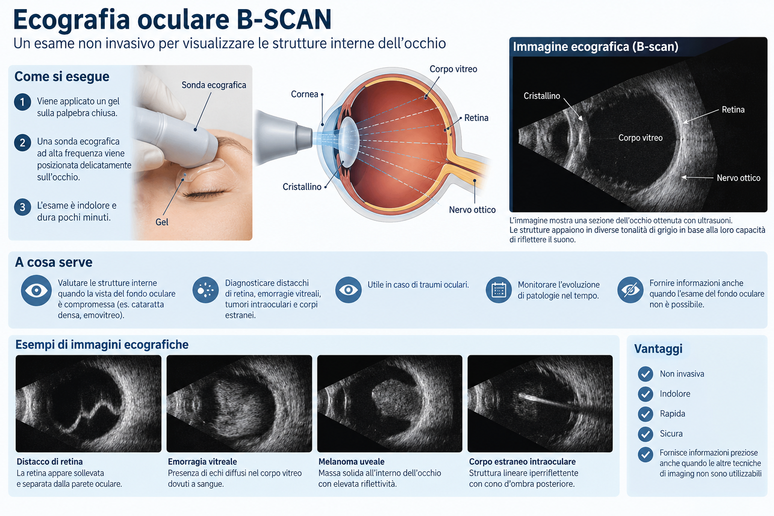 Infografica sull’ecografia oculare B-scan: come si esegue, a cosa serve ed esempi di immagini ecografiche